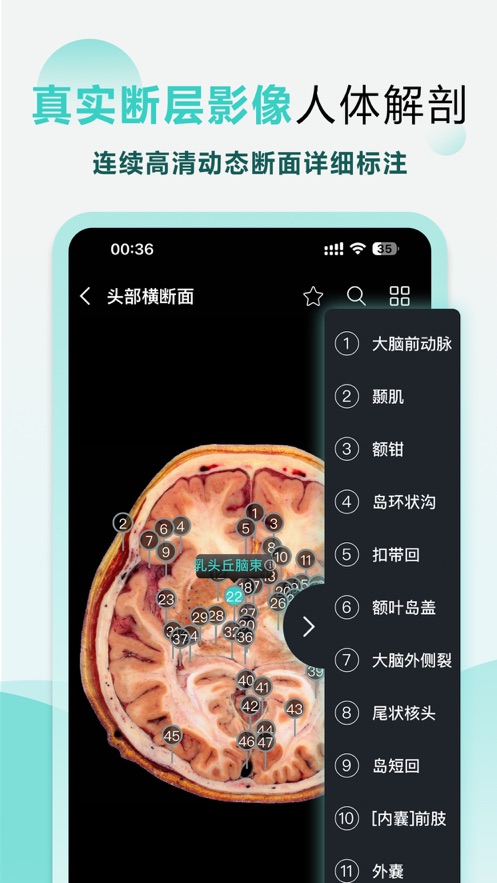 掌上3d解剖app