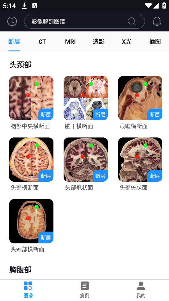 影像解剖图谱